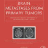 Brain Metastases from Primary Tumors, Volume 3: Epidemiology, Biology, and Therapy of Melanoma and Other Cancers 1st Edition Brain Metastases from Primary Tumors, Volume 3: Epidemiology, Biology, and Therapy of Melanoma and Other Cancers 1st Edition