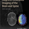 Magnetic Resonance Imaging of the Brain and Spine Fifth Edition PDF Magnetic Resonance Imaging of the Brain and Spine Fifth Edition PDF