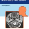 Differential Diagnosis in Neuroimaging: Head and Neck 1st Edition Differential Diagnosis in Neuroimaging: Head and Neck 1st Edition