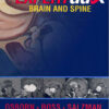 Expertddx: Brain and Spine 1st Edition PDF ORIGINAL Expertddx: Brain and Spine 1st Edition PDF ORIGINAL