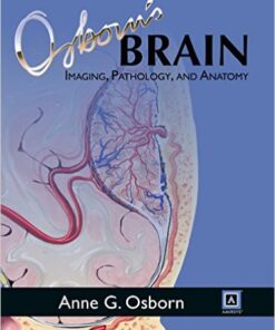 Osborn’s Brain, 1e CHM ORIGINAL