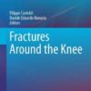 Fractures Around the Knee 2016 Fractures Around the Knee 2016
