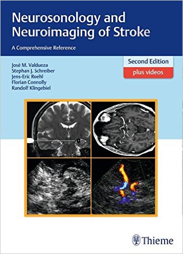 Neurosonology and Neuroimaging of Stroke : A Comprehensive Reference 2nd edition – Original PDF + (129 VIDEOS+ 8 Additional Files) Neurosonology and Neuroimaging of Stroke : A Comprehensive Reference 2nd edition – Original PDF + (129 VIDEOS+ 8 Additional Files)