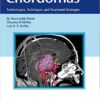Chordomas: Technologies, Techniques, and Treatment Strategies 1st Edition PDF Chordomas: Technologies, Techniques, and Treatment Strategies 1st Edition PDF