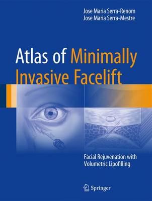 Atlas of Minimally Invasive Facelift 2016 : Facial Rejuvenation with Volumetric Lipofilling Atlas of Minimally Invasive Facelift 2016 : Facial Rejuvenation with Volumetric Lipofilling