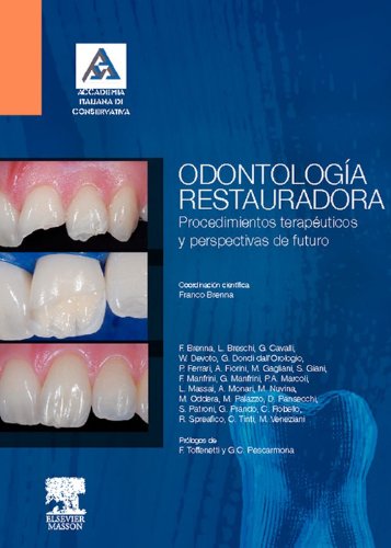 Odontología restauradora: Procedimientos terapéuticos y perspectivas de futuro (Spanish Edition)