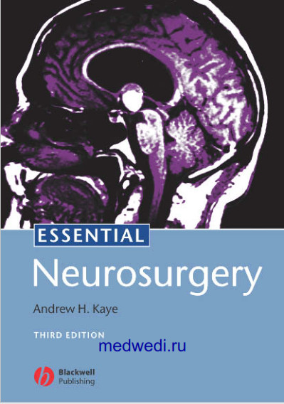 Essential Neurosurgery 3rd Edition PDF Essential Neurosurgery 3rd Edition PDF
