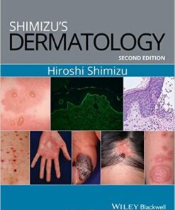 Shimizu’s Dermatology 2nd Edition PDF