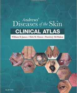 Andrews’ Diseases of the Skin Clinical Atlas, 1e PDF