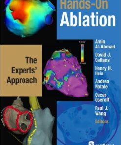 Hands-on Ablation: The Experts’ Approach 1st Edition