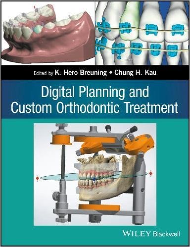 Digital Planning and Custom Orthodontic Treatment Digital Planning and Custom Orthodontic Treatment