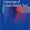 Colposcopy of Female Genital Tract 2017 Colposcopy of Female Genital Tract 2017
