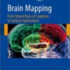 Brain Mapping: From Neural Basis of Cognition to Surgical Applications 2012th Edition Brain Mapping: From Neural Basis of Cognition to Surgical Applications 2012th Edition