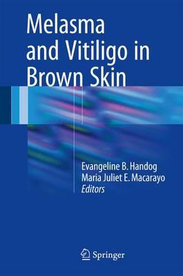 Melasma and Vitiligo in Brown Skin 1st ed. 2017 Edition Melasma and Vitiligo in Brown Skin 1st ed. 2017 Edition
