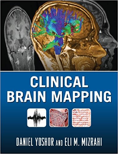 Clinical Brain Mapping 1st Edition Clinical Brain Mapping 1st Edition