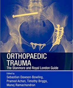 Orthopaedic Trauma: The Stanmore and Royal London Guide