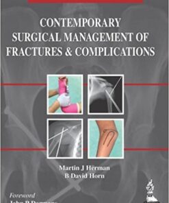 Contemporary Surgical Management of Fractures and Complications: Pediatrics (Volume 3)