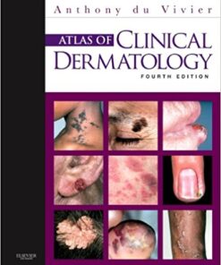 Atlas of Clinical Dermatology, 4e (du Vivier, Atlas of Clinical Dermatology) 4th Edition PDF