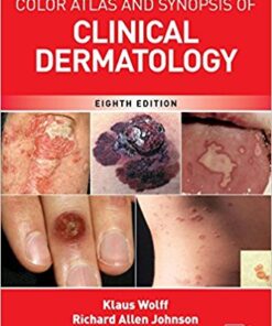 Fitzpatrick’s Color Atlas and Synopsis of Clinical Dermatology, Eighth Edition  PDF