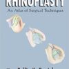 Rhinoplasty: An Atlas of Surgical Techniques 2002nd Edition PDF Rhinoplasty: An Atlas of Surgical Techniques 2002nd Edition PDF