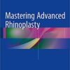 Mastering Advanced Rhinoplasty 1st ed. 2017 Edition PDF Mastering Advanced Rhinoplasty 1st ed. 2017 Edition PDF