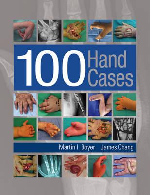 100 Hand Cases 1st Edition PDF 100 Hand Cases 1st Edition PDF