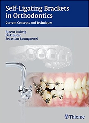 Self-ligating Brackets in Orthodontics: Current Concepts and Techniques 1st Edition PDF Self-ligating Brackets in Orthodontics: Current Concepts and Techniques 1st Edition PDF