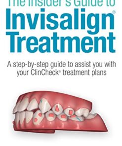 The Insider’s Guide to Invisilign Treatment : A step-by-step guide to assist your ClinCheck treatment plan PDF