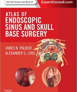 Atlas of Endoscopic Sinus and Skull Base Surgery: Expert Consult – Online and Print, 1e PDF
