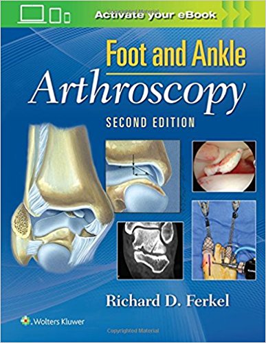 Foot & Ankle Arthroscopy Second Edition PDF Foot & Ankle Arthroscopy Second Edition PDF