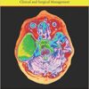 Arachnoid Cysts: Clinical and Surgical Management 1st Edition PDF Arachnoid Cysts: Clinical and Surgical Management 1st Edition PDF