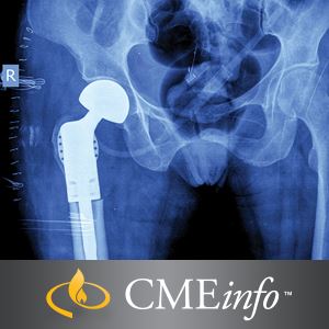 UCSF Neuro and Musculoskeletal Imaging 2017 (CME Videos) UCSF Neuro and Musculoskeletal Imaging 2017 (CME Videos)