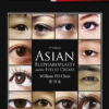 Asian Blepharoplasty and the Eyelid Crease, 3e PDF & VIDEO Asian Blepharoplasty and the Eyelid Crease, 3e PDF & VIDEO