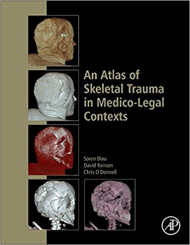 An Atlas of Skeletal Trauma in Medico-Legal Contexts PDF An Atlas of Skeletal Trauma in Medico-Legal Contexts PDF
