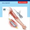 Handbook of Pain Surgery 1st Edition PDF