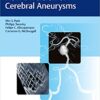 Flow Diversion of Cerebral Aneurysms 1st Edition PDF Flow Diversion of Cerebral Aneurysms 1st Edition PDF