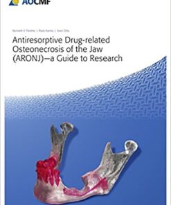 Antiresorptive Drug-Related Osteonecrosis of the Jaw (ARONJ) – A Guide to Research 1st Edition PDF