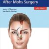 Facial Reconstruction After Mohs Surgery 1st Edition PDF & VIDEO Facial Reconstruction After Mohs Surgery 1st Edition PDF & VIDEO