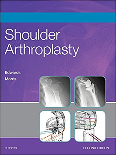 Shoulder Arthroplasty 2nd Edition PDF & Video Shoulder Arthroplasty 2nd Edition PDF & Video