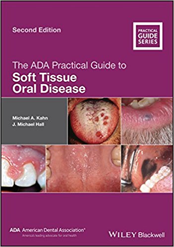 The ADA Practical Guide to Soft Tissue Oral Disease 2nd Edition PDF