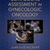 Ultrasound Assessment in Gynecologic Oncology 1st Edition PDF Ultrasound Assessment in Gynecologic Oncology 1st Edition PDF