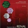 Diagnostic Atlas of Renal Pathology: Expert Consult – Online and Print, 2e Diagnostic Atlas of Renal Pathology: Expert Consult – Online and Print, 2e