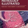 Pathology Illustrated, 7e Pathology Illustrated, 7e