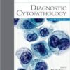 Diagnostic Cytopathology: Expert Consult Diagnostic Cytopathology: Expert Consult