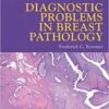 Diagnostic Problems in Breast Pathology, 1e Diagnostic Problems in Breast Pathology, 1e