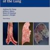 Thurlbeck’s Pathology of the Lung 3rd edition Edition Thurlbeck’s Pathology of the Lung 3rd edition Edition