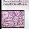 Biopsy Interpretation of the Uterine Cervix and Corpus (Biopsy Interpretation Series) Biopsy Interpretation of the Uterine Cervix and Corpus (Biopsy Interpretation Series)