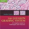 The Gleason Grading System: A Complete Guide for Pathologist and Clinicians The Gleason Grading System: A Complete Guide for Pathologist and Clinicians