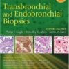 Transbronchial and Endobronchial Biopsies Transbronchial and Endobronchial Biopsies