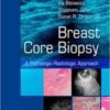Breast Core Biopsy: A Pathologic-Radiologic Approach, 1e Breast Core Biopsy: A Pathologic-Radiologic Approach, 1e